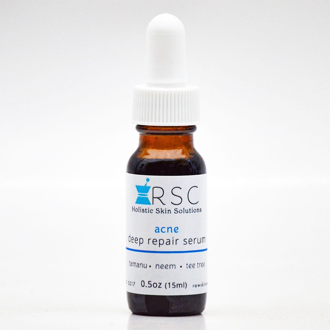 Natural Acne Deep Repair Serum